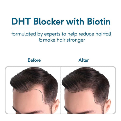 HK Vitals DHT Blocker with Biotin